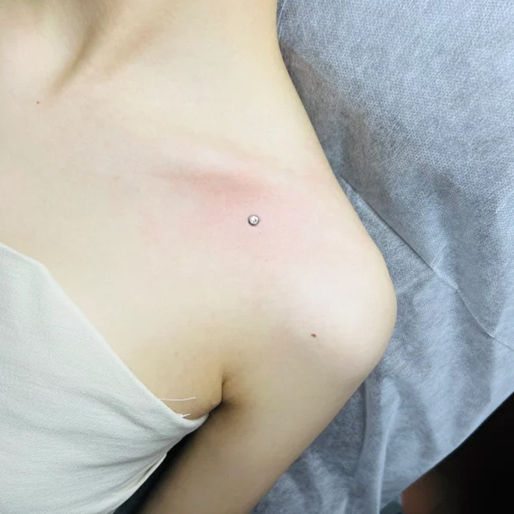 Piercing di superficie in acci - Body Jewelry Dermal recensione e prezzo